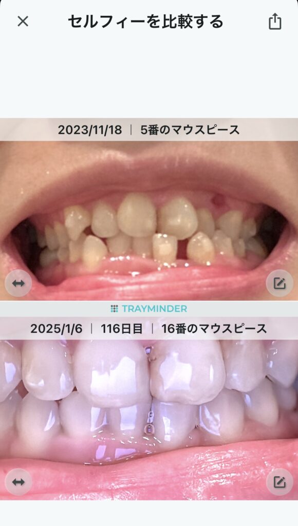 Tray Minderで経過写真を比較しているスクリーンショット